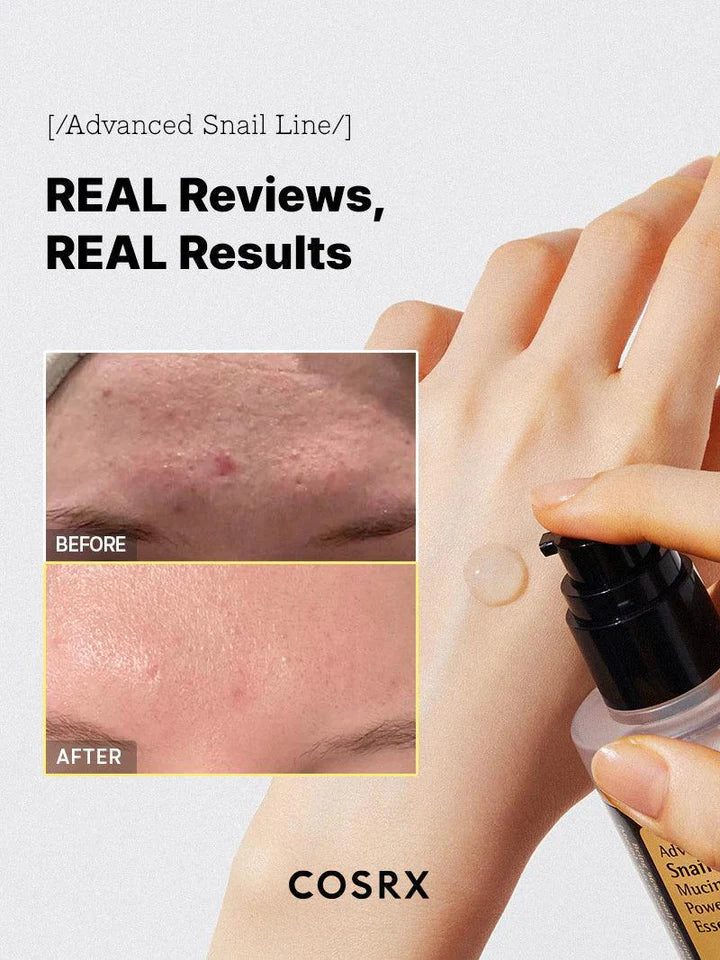 Cosrx Advanced Snail 96 Mucin Repairing Serum 100ml, Korean Skin Care