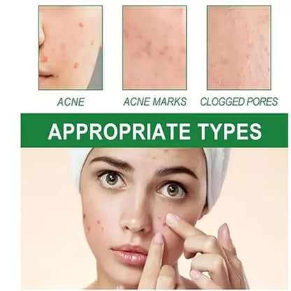 Lion Pair Acne Cream 14ml, Japanese Formula for Pimples, Redness & Inflammation – Fast-Acting, Non-Irritating Spot Treatment